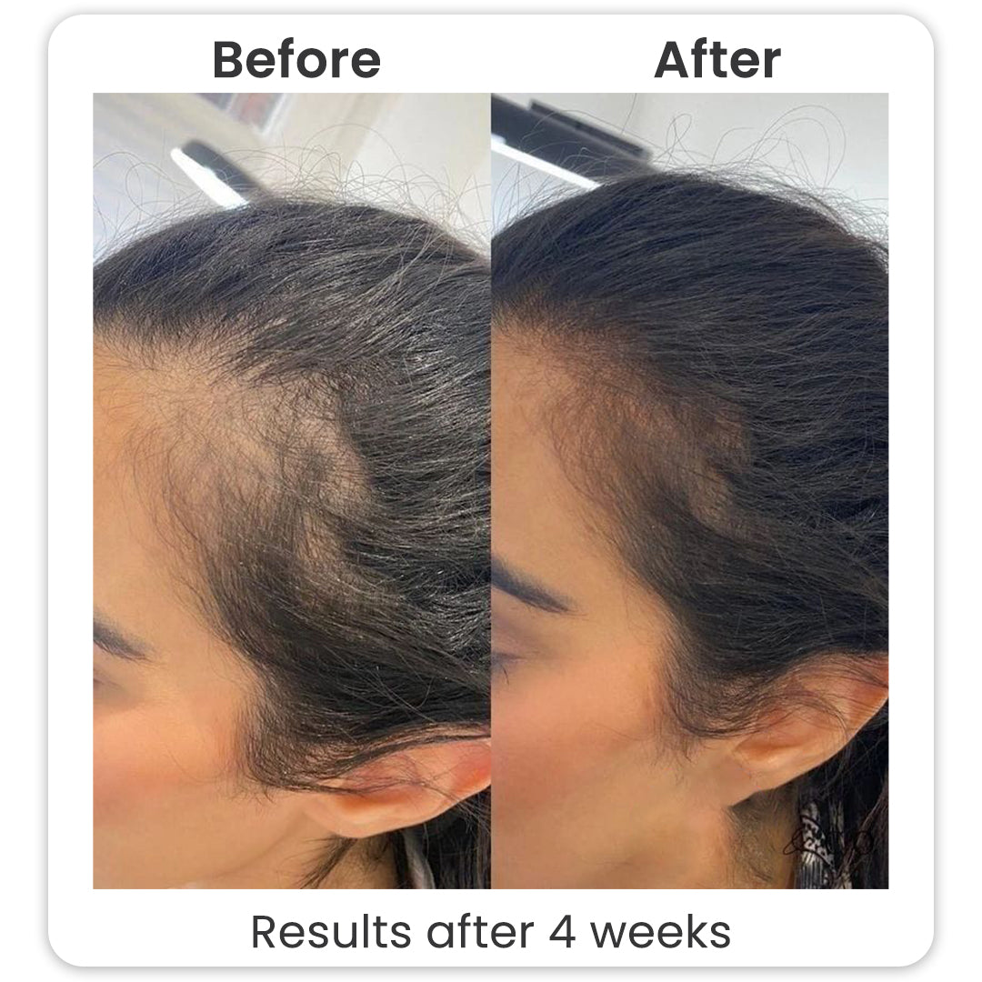 Root Revival Toner