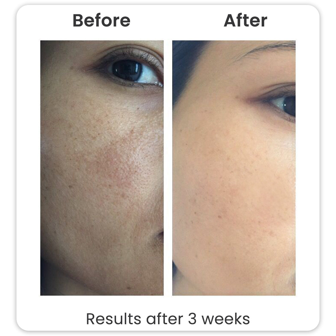 Glycolic Acid Toner
