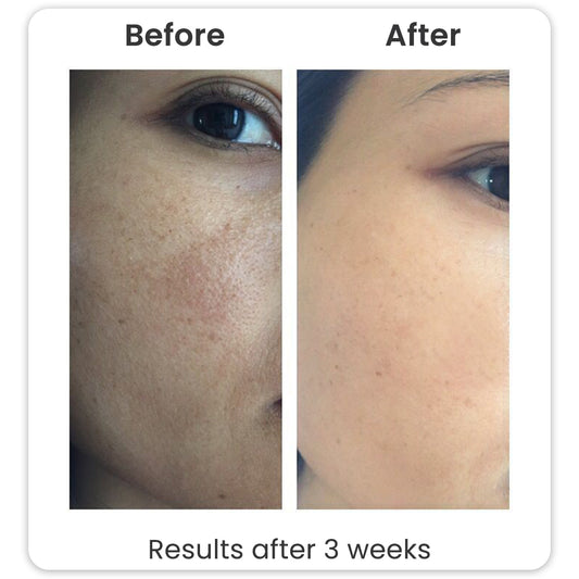 Glycolic Acid Toner